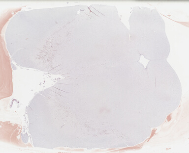 ['deident_57d103d2-810d-4704-80aa-e78ad06ceca2_69b0464d.jpg']
