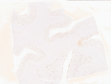 ['deident_6c99863c-2be6-4001-b0f9-0394fb75802c_69b04d39.jpg']