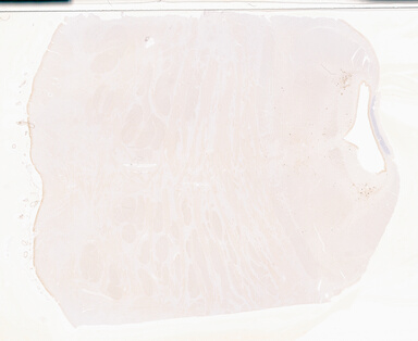 ['deident_607b0d7c-0739-4777-be1d-59d105207827_69b04d33.jpg']