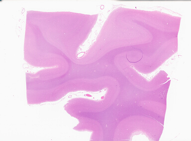 ['deident_e6f11943-547a-4d84-b9f5-3f87889e53f0_69b04d74.jpg']