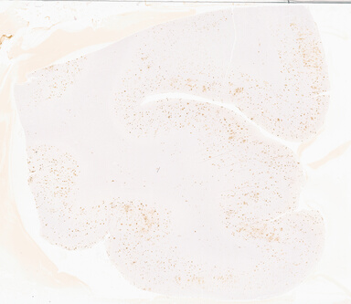 ['deident_ec238acd-3793-460c-b2bb-677754c49529_69b04d7c.jpg']