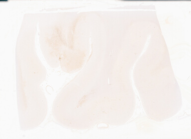 ['deident_f88b9c37-e512-4e08-9556-b6332089ccf3_69b04d7f.jpg']