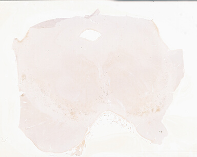 ['deident_53c48baf-5f2b-4c9c-86d9-89b8014d6651_69b04d2a.jpg']