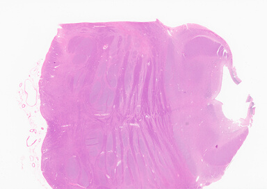 ['deident_e79cf35c-8892-445b-afaf-c7c0911f5a10_69b04d76.jpg']