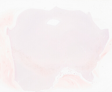 ['deident_3b1a552f-3ade-4933-8cf0-b3d4cb5a5679_69b04d13.jpg']