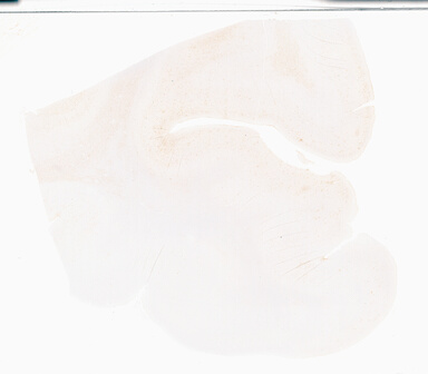 ['deident_e92262e4-8f14-4764-8826-beacf92289d8_69b04d7b.jpg']