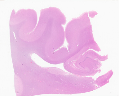 ['deident_36c81943-017b-46b0-a56f-99eba95f55ca_69b04d11.jpg']