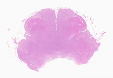 ['deident_5e37aa0d-38e7-4bbb-85f7-83e09e5798bb_69b04d32.jpg']