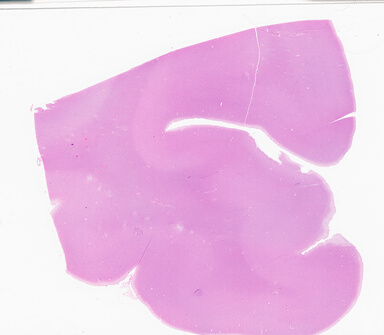 ['deident_fea0e329-92d0-4dc9-bded-755e6f319ee2_69b04d81.jpg']