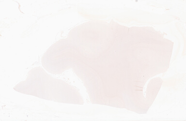 ['deident_96a76c04-f720-4f59-b934-2bb6ff2ec116_69b06498.jpg']