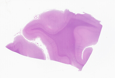 ['deident_03580557-c8d0-499d-bfba-330a813a85ed_69b0645b.jpg']