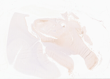 ['deident_0681555c-86b0-4111-b9a9-da0f8282f54a_69b0645d.jpg']