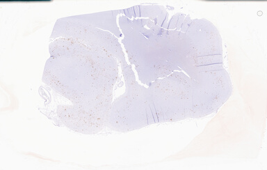 ['deident_d740f433-78e9-407c-a643-a1c6a49ffe5d_69b064b7.jpg']