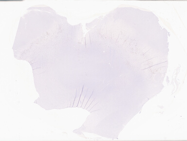 ['deident_171b81ce-9757-4fbb-8ae6-442e36a5ea2b_69b06468.jpg']