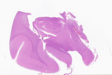 ['deident_3daa3b64-4011-4580-b434-b0afd8e99ab0_69b0646d.jpg']