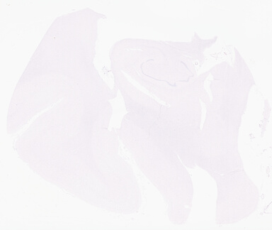['deident_70b67dbb-fa75-483f-bc1a-a768f7940163_69b06484.jpg']