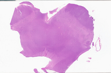 ['deident_0a911102-ba78-4efa-983c-dbdbf82d19dc_69b0645f.jpg']