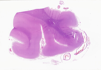 ['deident_4f52369f-cb92-46c8-b0d1-d661ef3af2b2_69d92381.jpg']