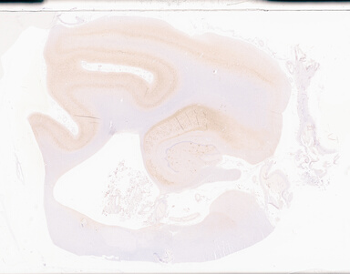 ['deident_d1ba976e-7263-4008-a0a7-ad30161272be_69d94aba.jpg']