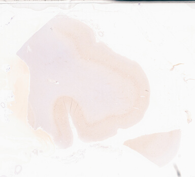 ['deident_9e2ef908-fd0e-4545-9e3d-430d656108e9_69d94aa0.jpg']