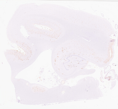 ['deident_9fd92bef-34be-489b-af72-3acc88f9a351_69d94aa1.jpg']