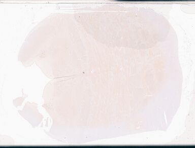 ['deident_13492b41-b005-4913-99e3-c7fbae0d13bb_69d94a44.jpg']