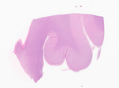 ['deident_697192be-a6c3-485d-aaf6-d1b8c7f28eeb_69d94a8a.jpg']