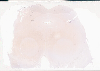 ['deident_10153c83-45a6-4c71-8aa8-b83727876284_69d94a3e.jpg']