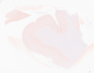 ['deident_d0e3267f-b688-4222-9f56-a4cb0a7a6892_69d94ab8.jpg']