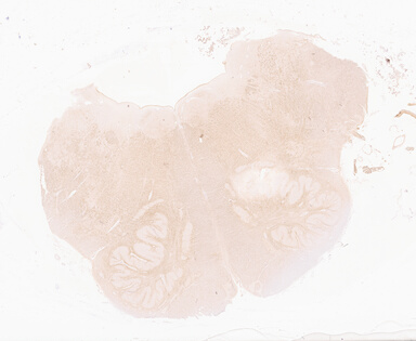 ['deident_179b649f-2c07-40f3-b028-aac11cafb720_69d94a4a.jpg']