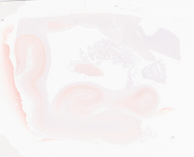 ['deident_3e905e68-299e-4d8d-8cc4-1799eadde5a2_69d94a6e.jpg']