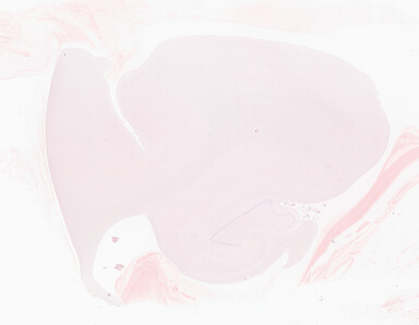 ['deident_16ad75f6-6005-45e6-8ed0-fec4212094d5_69b060d4.jpg']