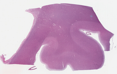 ['deident_e4b2647d-41d1-4e0b-a9ae-2d0c9ce29349_69b0356f.jpg']