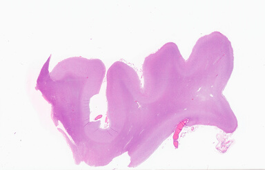 ['deident_6da3cf2a-b22e-4e80-9fdb-5955cd485d6f_69b05e97.jpg']