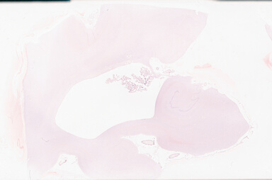 ['deident_44990dd9-cd42-4428-9fb1-de11eec2db50_69b05e88.jpg']