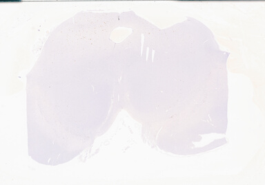 ['deident_876a1ad2-1b41-404e-a651-cceb611ab5bd_69b05e9f.jpg']