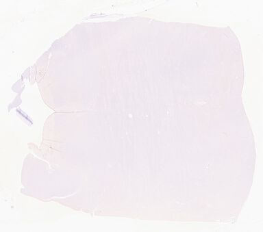 ['deident_14144c37-6cd2-4023-b6eb-a1d0b575b150_69b02a15.jpg']