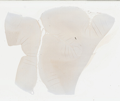 ['deident_2ee0db3a-c342-4f4e-92fc-cb6a42b99c2b_69b02a27.jpg']
