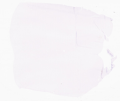 ['deident_29563b73-e16f-4c0a-be91-3191ea10d8fd_69b02a1d.jpg']
