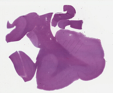['deident_d5f2aa95-73c7-43ce-8a1c-43ebdc1e2da4_69b02a69.jpg']
