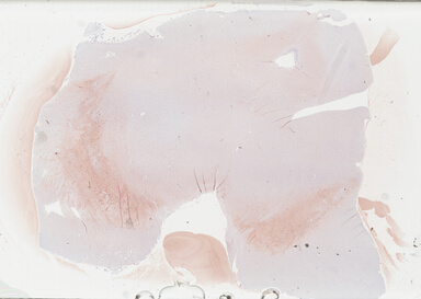 ['deident_29e70a6b-b20f-4788-ae26-9e6c6d8635ef_69b02a1f.jpg']