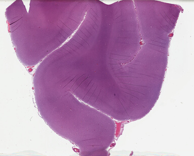 ['deident_3ebd7de6-988c-436c-9d48-f8400805c8cb_69b02a31.jpg']
