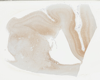 ['deident_6cf5f96c-5982-48cd-bd49-961aa4729257_695fcd58.jpg']