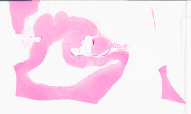 ['deident_c86e4200-b310-4d54-b0f4-19484ab09f8f_695fcd6b.jpg']