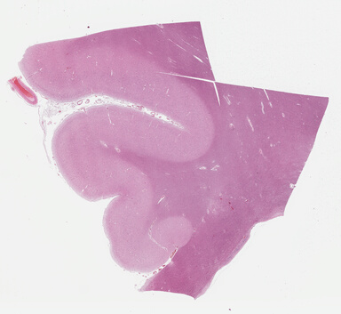 ['deident_436a2b42-d7d6-41a2-9fc7-022a8d34d341_695fcd4a.jpg']