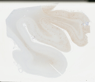 ['deident_5f3f854a-052d-4e3a-800e-9da5016e8121_695fcd55.jpg']