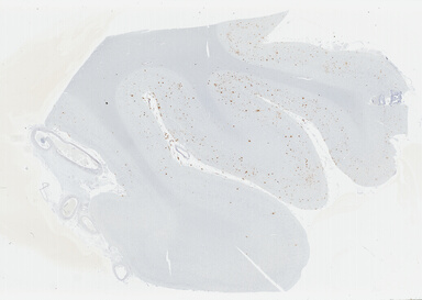 ['deident_0d5bbd40-75d9-4306-8249-77b13e25fc7d_695fcd33.jpg']