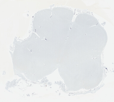['deident_f617eb99-c1ee-477e-829a-fbe4d269a5ab_695fcd86.jpg']