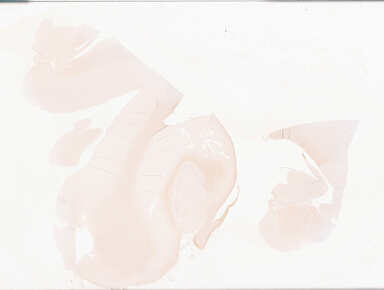 ['deident_6de3d6e8-73a7-4e26-8050-e1301aa30661_69d93983.jpg']