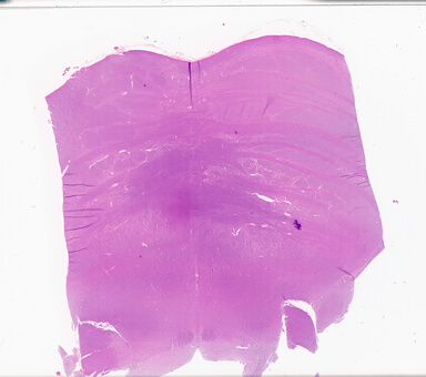 ['deident_97cde38f-b0fd-4811-b1b0-1ebb91d3bc0f_69d93990.jpg']